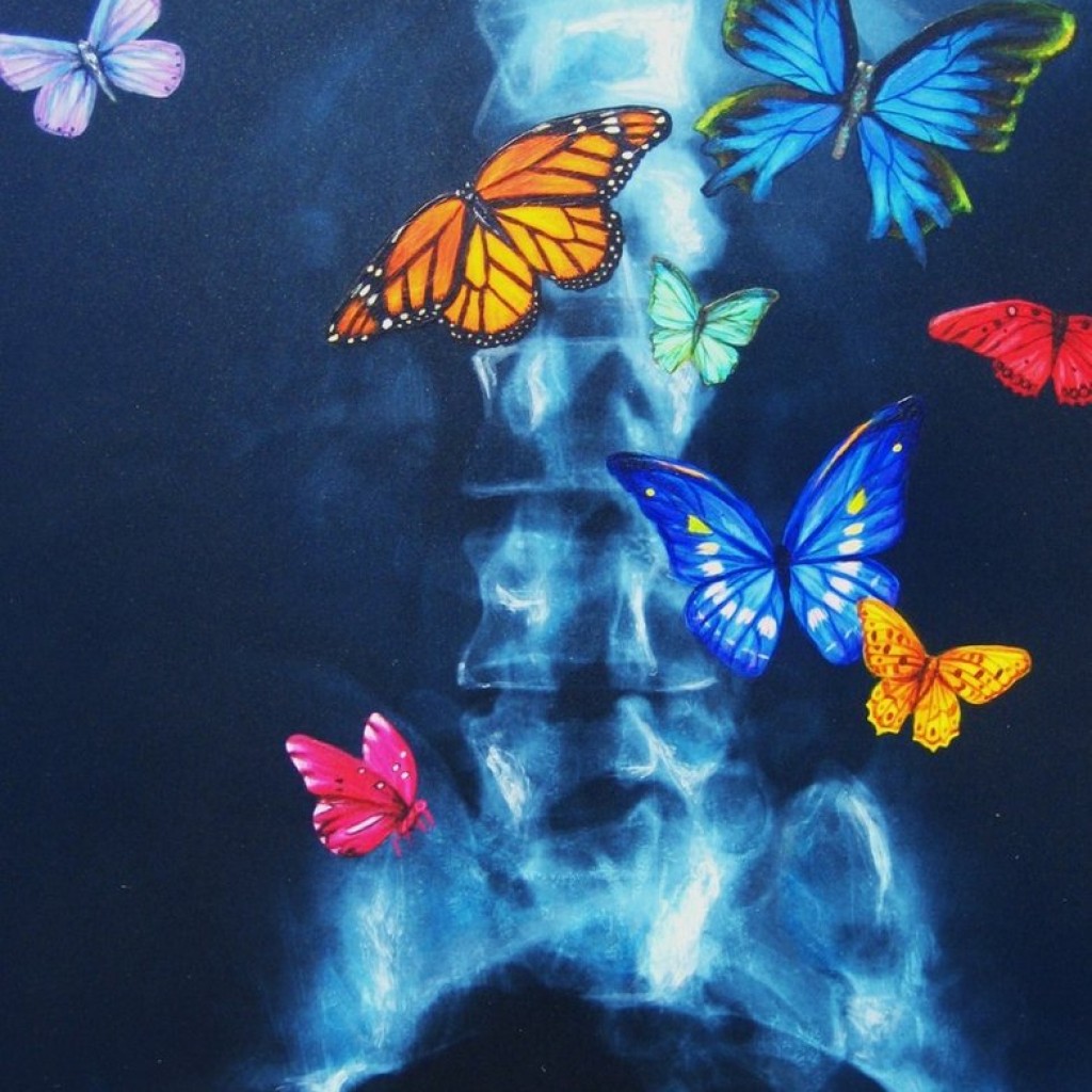 Butterflies_In_Your_Stomach_by_yarnuh