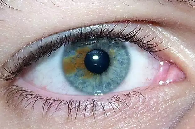 Kék szem
