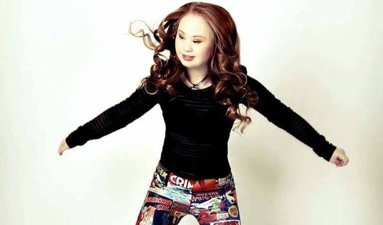 Down-szindrómás modellek a kifutón