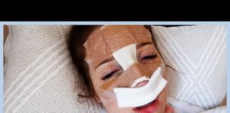 Orrműtétjéről mesél őszintén a népszerű youtuber