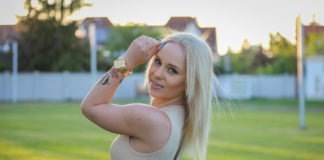 Zsanika csúnyán leégett napozás közben