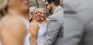 Férjhez ment a kétfejű sziámi ikerpár egyik tagja